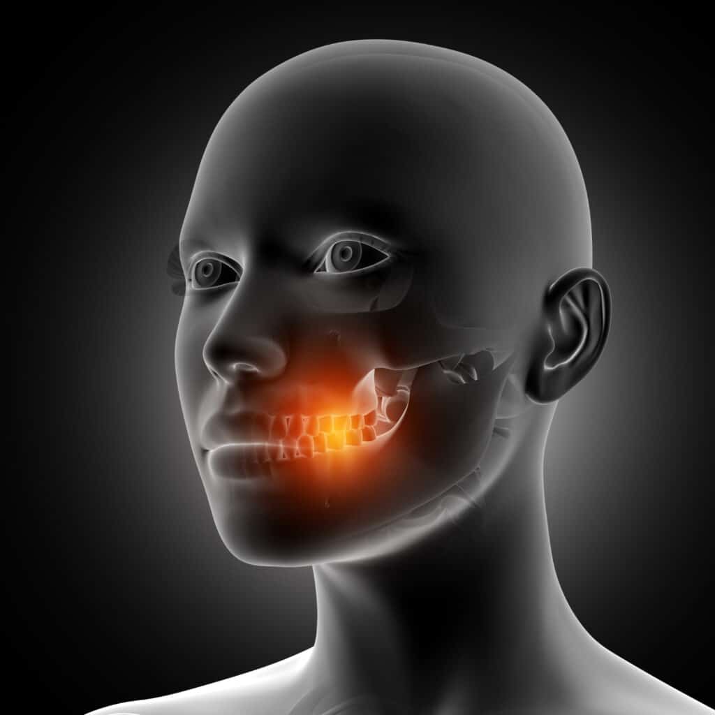tomografia de mandíbula