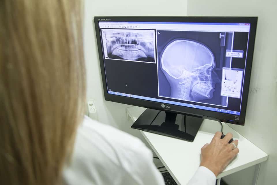 Radiologia odontológica na tela monitor - radiologia odontológica