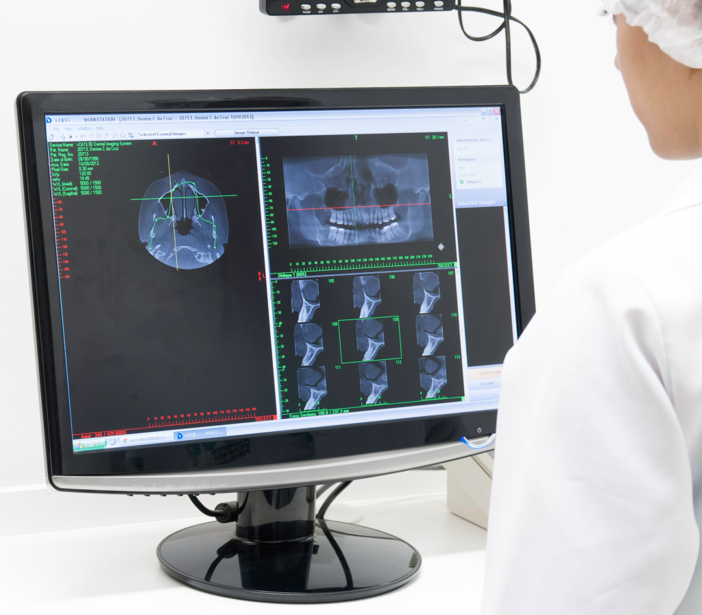 analisando imagens radiograficas