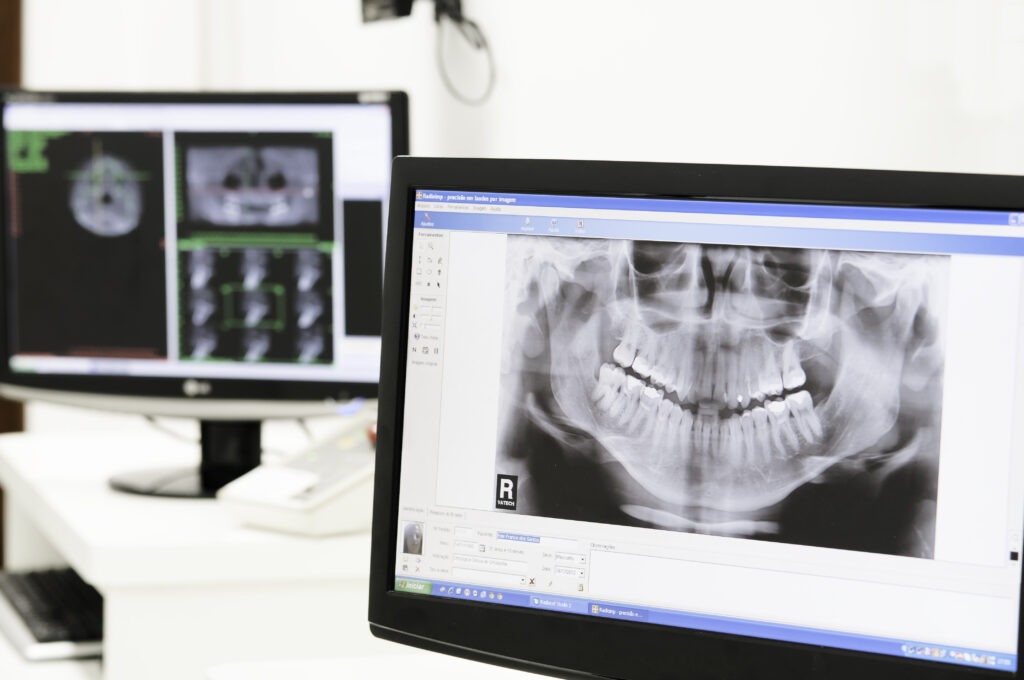 Radiologia Odontológica