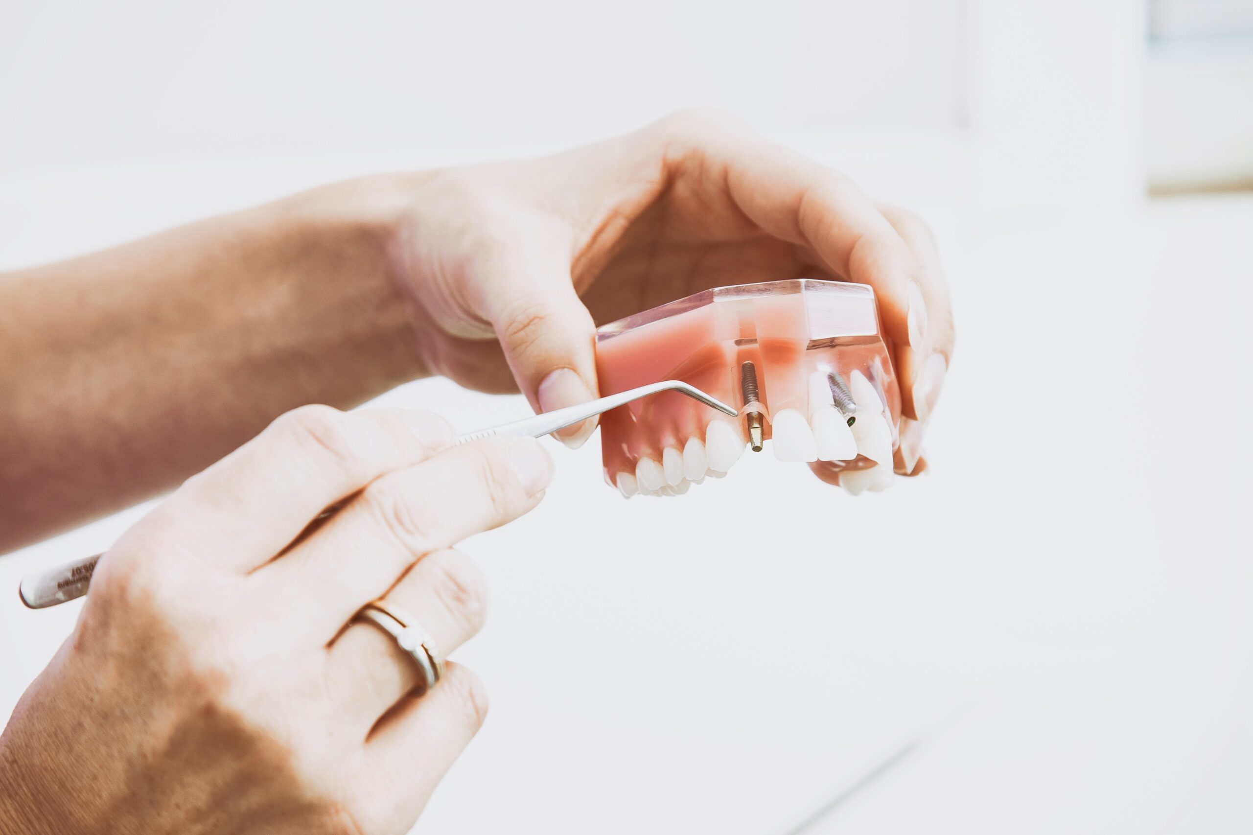 mãos encaixando prótese em uma dentadura