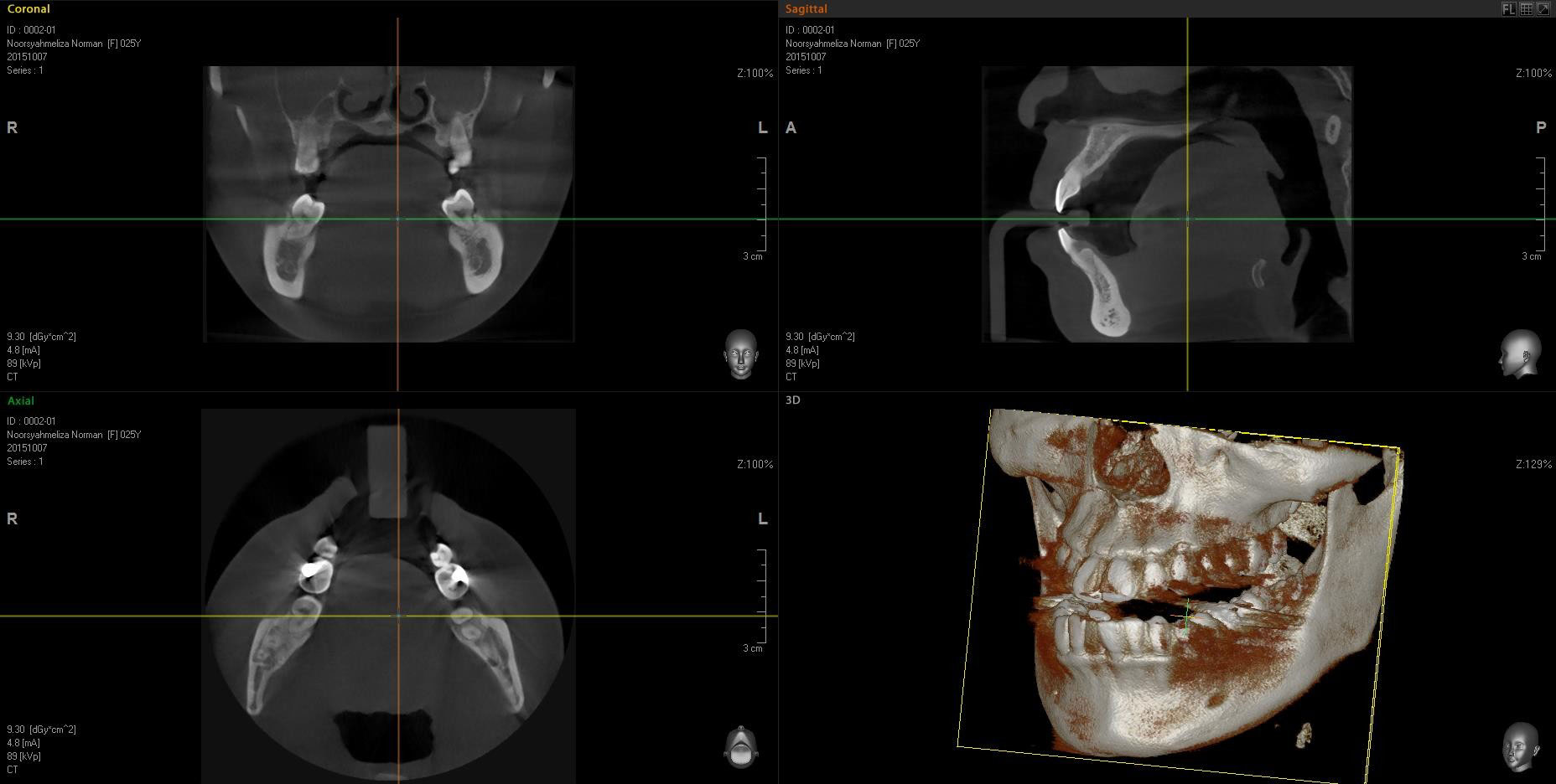 Entenda como funciona a tomografia Cone Beam e o papel dela na odontologia