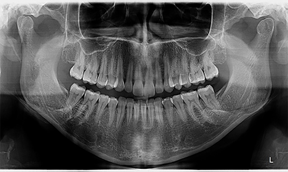 radiografia panorâmica odontológica
