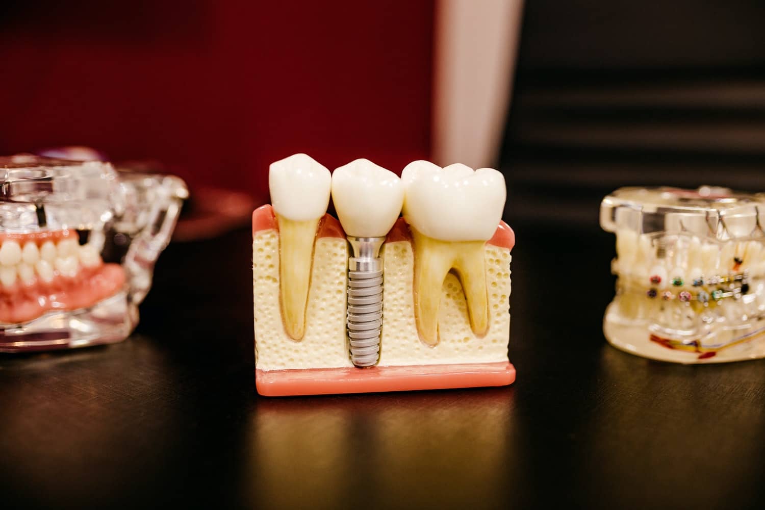 modelos prototipados na Odontologia