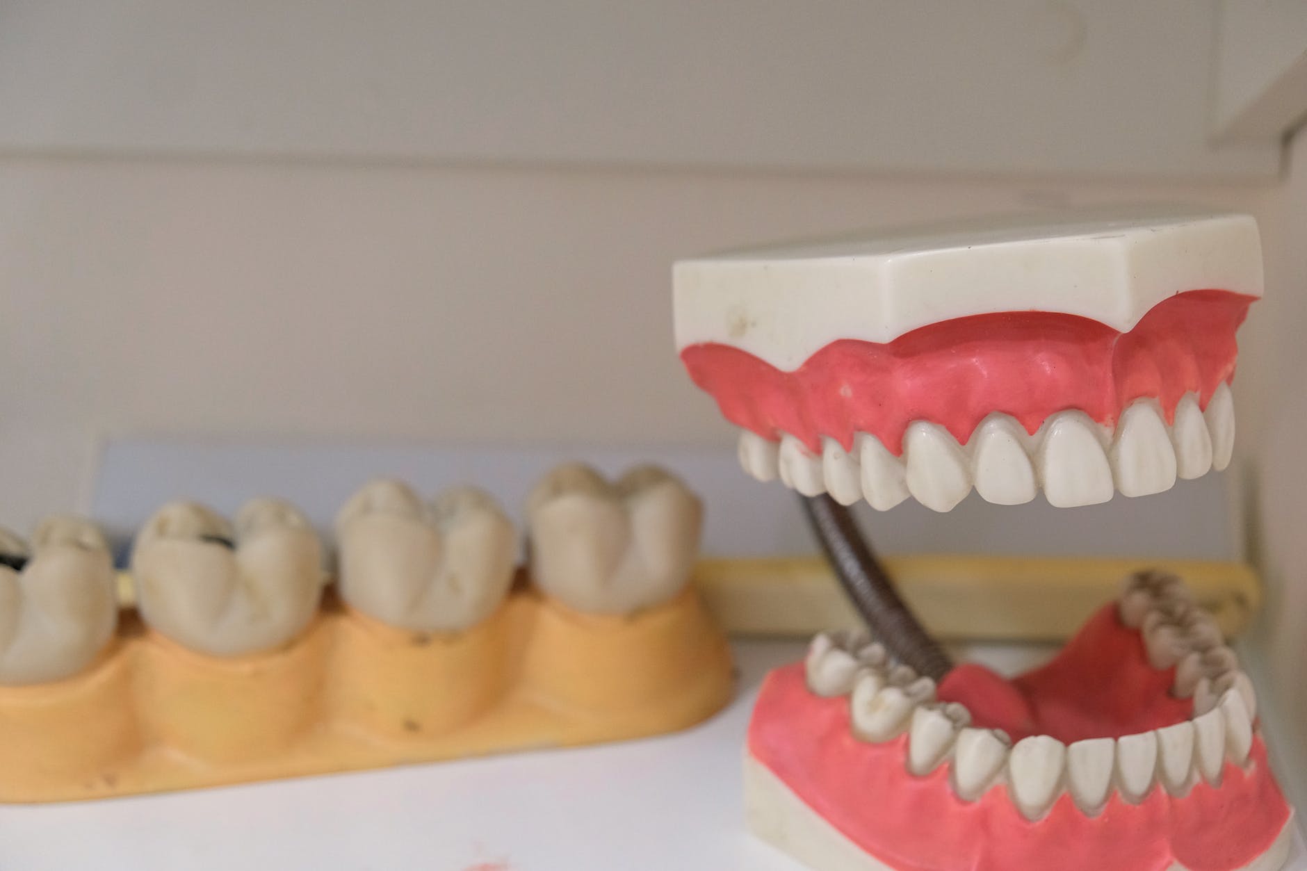 tipos de prótese dentária