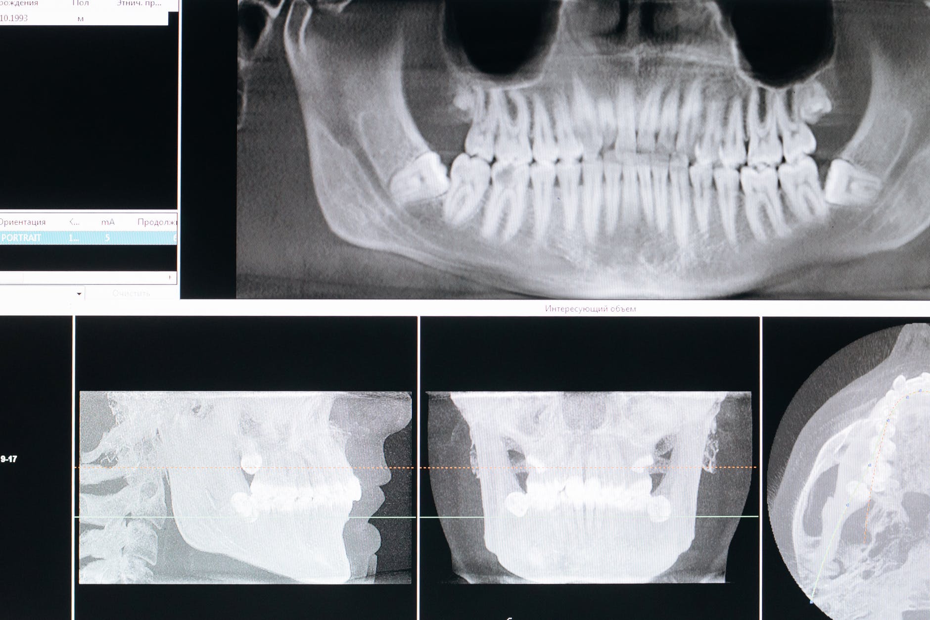 radiologia odontológica